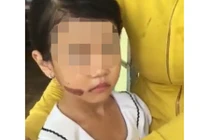 Thêm tình tiết mới trong vụ bé gái nghi bị bạo hành ở Kiên Giang