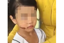 Thêm tình tiết mới trong vụ bé gái nghi bị bạo hành ở Kiên Giang