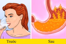 Duy trì 6 thói quen tai hại này sẽ khiến trào ngược dạ dày nghiêm trọng hơn