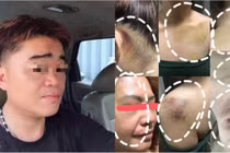 Chồng đánh vợ tới biến dạng, bạo hành con cái gây sửng sốt