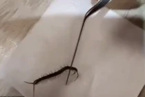 Rùng mình con vật gớm ghiếc sống trong tai người phụ nữ ở Đài Loan