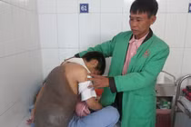 Chàng trai trẻ mang "mai rùa" suốt nhiều năm