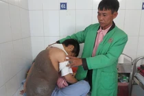 Chàng trai trẻ mang "mai rùa" suốt nhiều năm