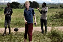 Điều gì khiến người bạch tạng trở thành mục tiêu săn lùng?