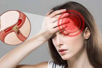 Bị thiếu máu não đừng chủ quan vì có thể gây đột quỵ