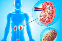 Bài thuốc dân gian "đánh tan" sỏi thận thần tốc chỉ từ quả dứa