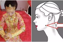 Vị trí vàng của nốt ruồi tài lộc, dự báo cả đời ăn không hết của