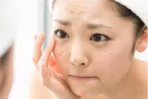 Chị em bị mất cân bằng nội tiết nữ nếu thấy dấu hiệu này 