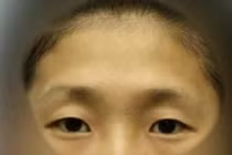 Tướng mặt phụ nữ dễ có cuộc đời cay đắng, sinh ra đã vất vả