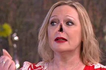 Video: Người phụ nữ gây sốc khi tháo mũi giả trên sóng truyền hình