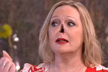 Video: Người phụ nữ gây sốc khi tháo mũi giả trên sóng truyền hình