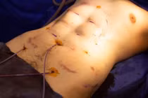 Sự thật về phương pháp 'tạc' cơ bụng sáu múi