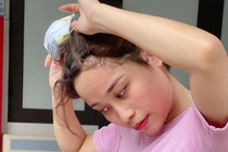 Vết hằn khẩu trang trên mặt các y bác sĩ tại tâm dịch Bắc Giang