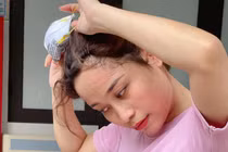 Vết hằn khẩu trang trên mặt các y bác sĩ tại tâm dịch Bắc Giang