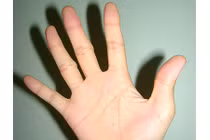 Nhìn kẽ hở bàn tay biết ngay tương lai sang hèn