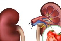 Gặp 6 dấu hiệu này sau khi ăn cà chua thì nên hạn chế lại ngay
