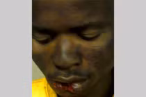 Giả vờ xách đồ giúp rồi nổi thú tính, yêu râu xanh bị cắn rách môi