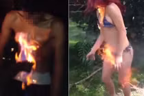 Giới trẻ đặt cược tính mạng với trào lưu ngu xuẩn "thử thách lửa"