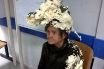 Tưởng là keo bọt, người phụ nữ vuốt lên đầu, bàng hoàng kết quả...