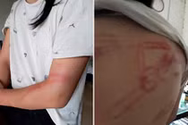 Lá đơn kêu cứu của bà ngoại có hai cháu bị bố đẻ bạo hành