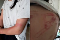 Lá đơn kêu cứu của bà ngoại có hai cháu bị bố đẻ bạo hành