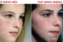 6 điều tội tệ xảy ra khi bạn thở bằng miệng trong lúc ngủ