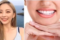 Nhìn tướng răng vài giây, biết ngay tương lai giàu sang hay khốn khó 