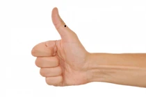 Soi vận mệnh người có nốt ruồi ở bàn tay