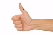 Soi vận mệnh người có nốt ruồi ở bàn tay