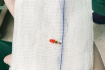 Cảnh giác với những món đồ chơi gây nguy hiểm tính mạng trẻ