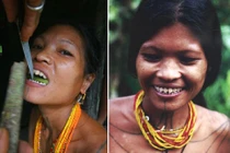 Những phong tục làm đẹp rùng rợn nhất trên thế giới