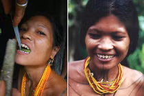 Những phong tục làm đẹp rùng rợn nhất trên thế giới