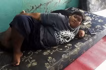 Cậu bé béo nhất thế giới nặng gần 2 tạ "đổi đời" vì giảm cân