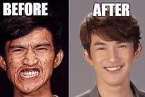 Vỡ mộng với "mặt gốc" không như là mơ của loạt mỹ nam, mỹ nữ Thái