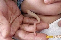Thực hư bé sơ sinh mọc đuôi dài miên man khiến cư dân mạng xôn xao