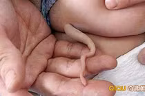 Thực hư bé sơ sinh mọc đuôi dài miên man khiến cư dân mạng xôn xao