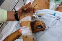 Vụ Việt kiều Canada bị tạt axit, cắt gân chân: Hung thủ vẫn bí ẩn