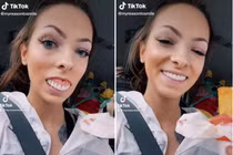 Cô gái 24 tuổi thích khoe hàm răng giả khiến dân mạng sửng sốt