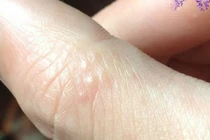 Thấy tay có dấu hiệu này hãy nhanh chân tới bệnh viện ngay