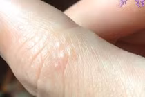 Thấy tay có dấu hiệu này hãy nhanh chân tới bệnh viện ngay