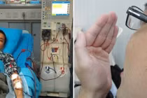 2 bộ phận bốc mùi hôi chứng tỏ thận suy yếu lắm rồi