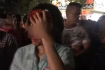 Xót xa người vợ bị chồng đánh đến chảy máu đầu phải nhập viện