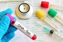 Xét nghiệm ADN mới hay con trai không phải của chồng