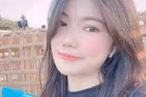 Hành trình lấy lại nhan sắc sau 20 lần phẫu thuật của cô gái bị tạt axit