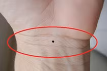 Ai sở hữu 6 nốt ruồi này trong bàn tay, tiền tiêu cả đời không hết