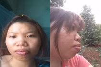 Cô gái từng bị chồng bỏ vì xấu như Thị Nở