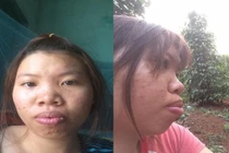 Cô gái từng bị chồng bỏ vì xấu như Thị Nở