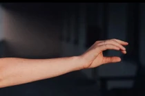 30% chúng ta mọc thêm thứ kỳ lạ trong cánh tay