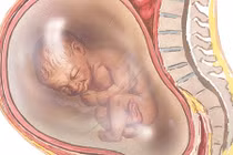 Tại sao trẻ có thể chết ngay tức khắc sau sinh vì thuốc lá?