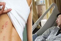 Tại sao có bệnh khi phát hiện đã giai đoạn cuối?